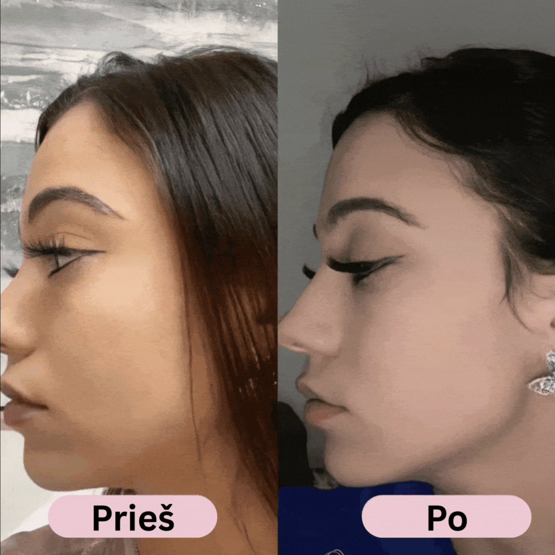 Glowie™ Veido Formavimo Įrankis