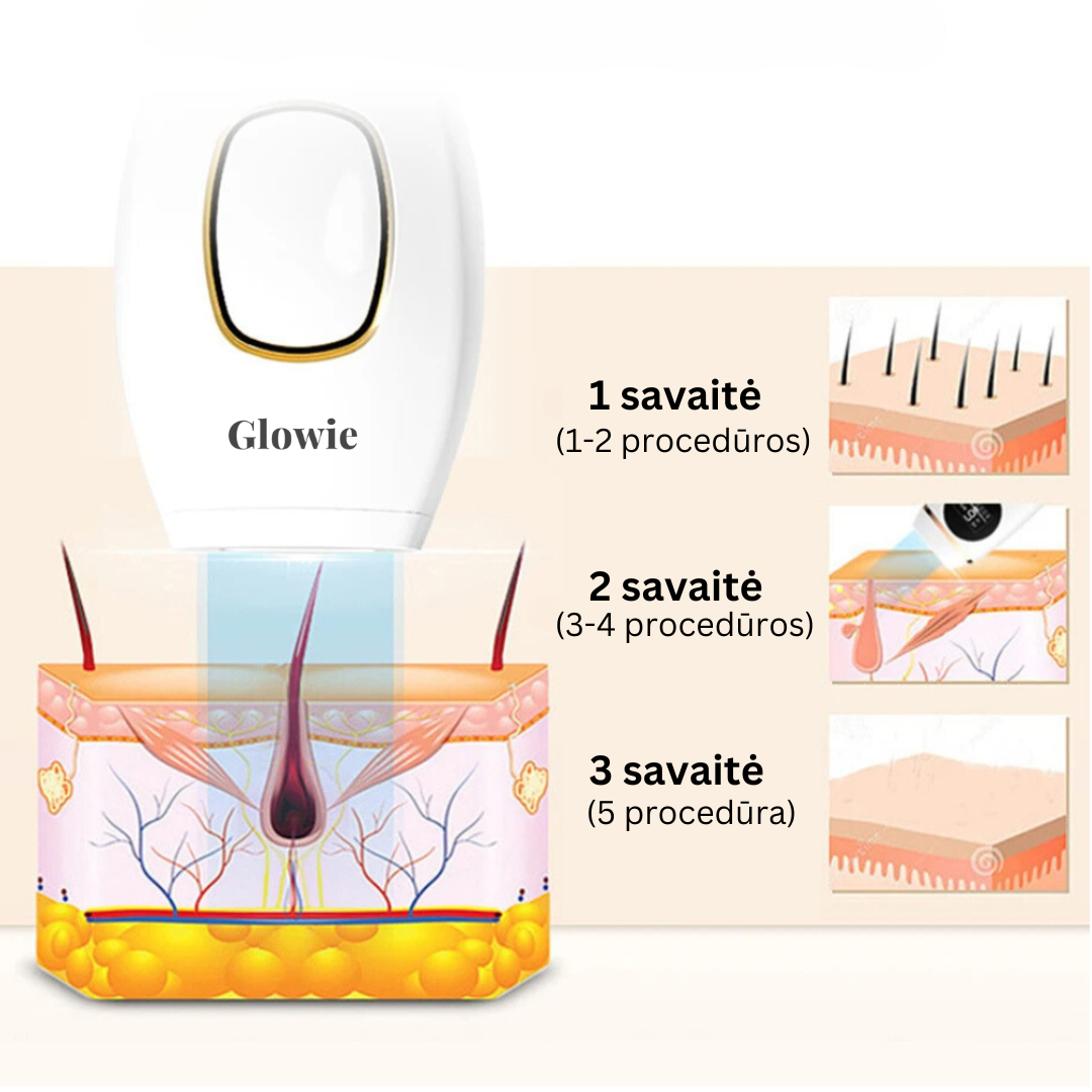 Glowie™ IPL fotoepiliatorius