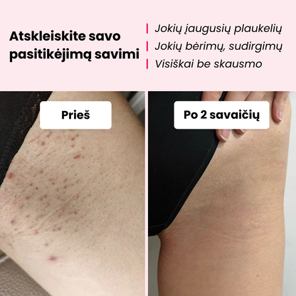 Glowie™ plaukelių šalinimo rinkinys